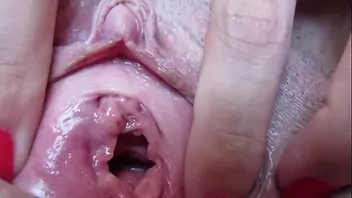 Insertion urethra